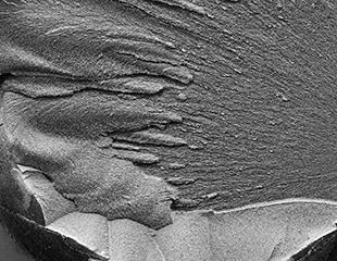 Fracture Patterns on Metal Fracture Surfaces and Solutions for Problems in Metallurgical Failure Analysis