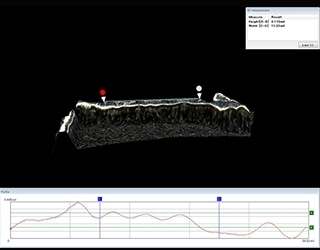 Bioabsorbable stent 3D shape and profile measurement