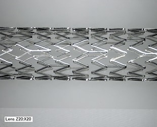 Bilderfassung eines Stents aus beliebigem Winkel (20x)