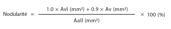 Calcul de la nodularité du graphite