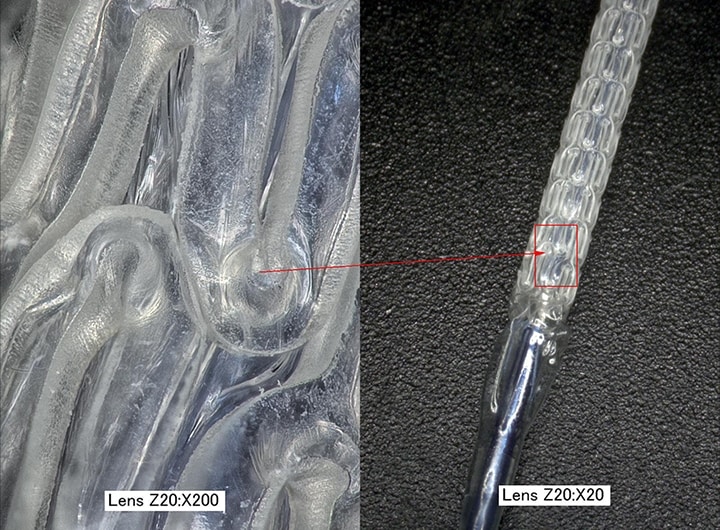 Obrazy biowchłanialnego stentu w powiększeniu (po lewej: 200×/po prawej: 20×)