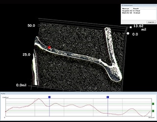 Pomiar kształtu 3D i profilu stentu biowchłanialnego